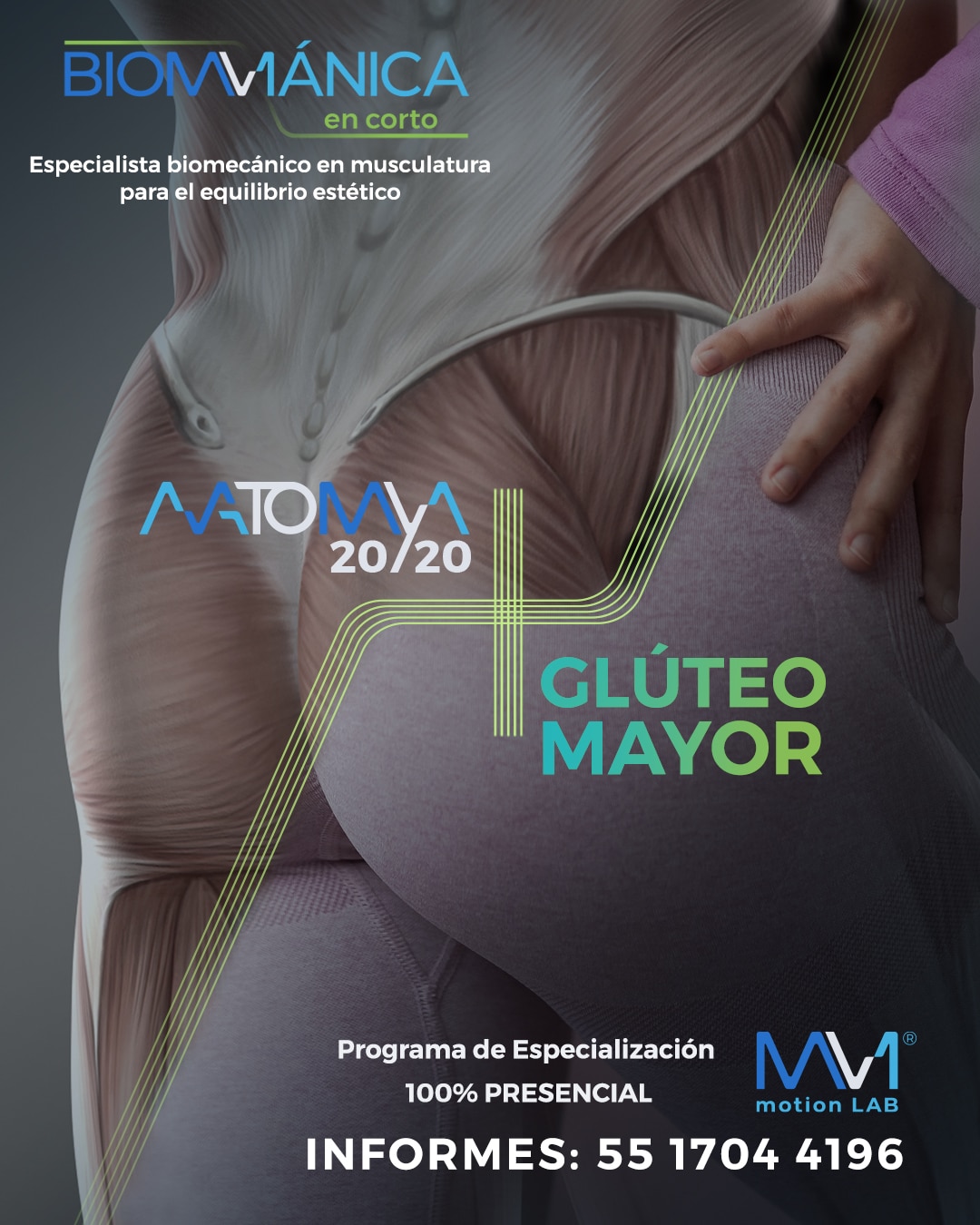 Módulo: Glúteo Mayor + Anatomya 20/20